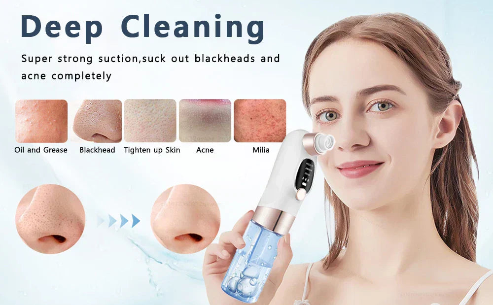 Electric Blackhead Remover Vacuum - Pore Face Cleaner