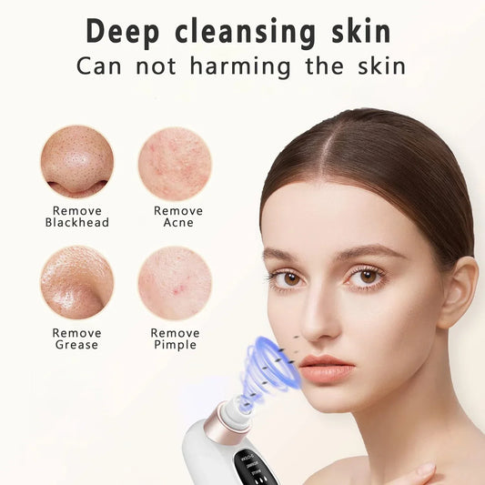 Electric Blackhead Remover Vacuum - Pore Face Cleaner